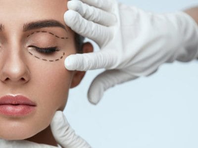 Göz Altı Morluk Tedavisi