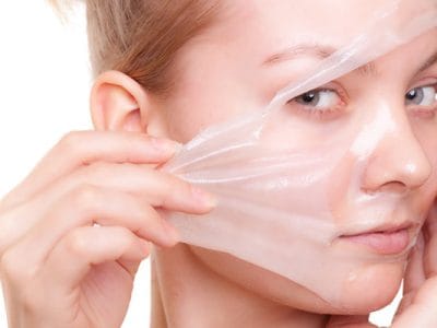 Kimyasal Peeling
