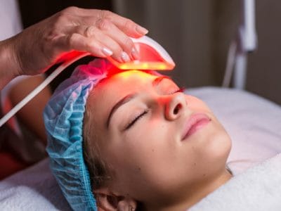 Lazerle Cilt Yenileme