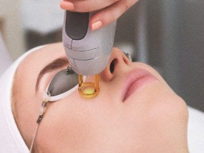 Q Switched ND Yağ Lazer