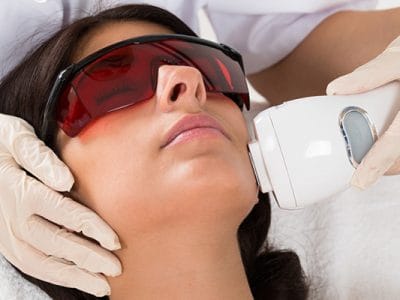 Lazerle Leke Tedavisi